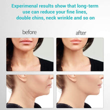 Load image into Gallery viewer, Divine Body™ - Skin Rejuvenating Device

